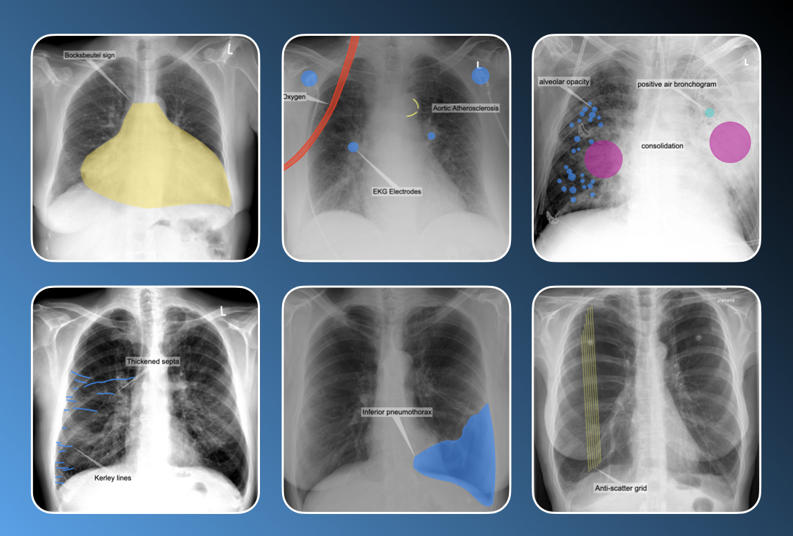 Chest X-ray Trainer | Part 2