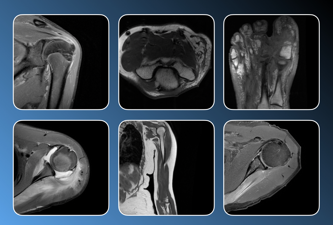 Imaging of Infection