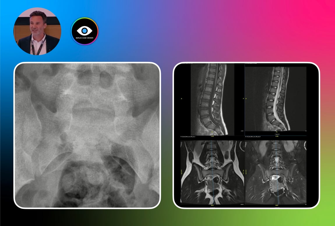 MRI of the SIJ in the Pediatric Population