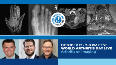 World Arthritis Day 2026