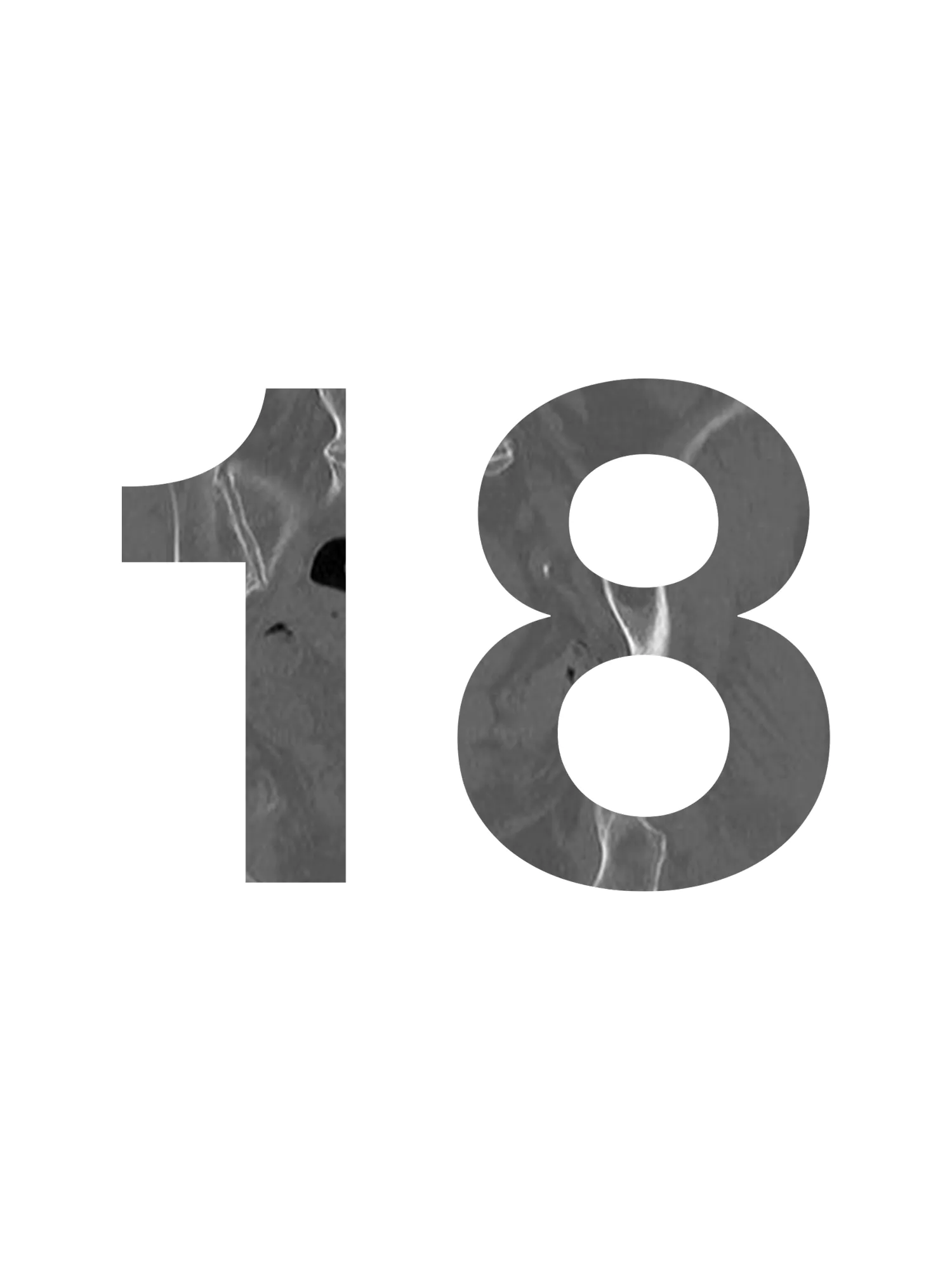Door 18