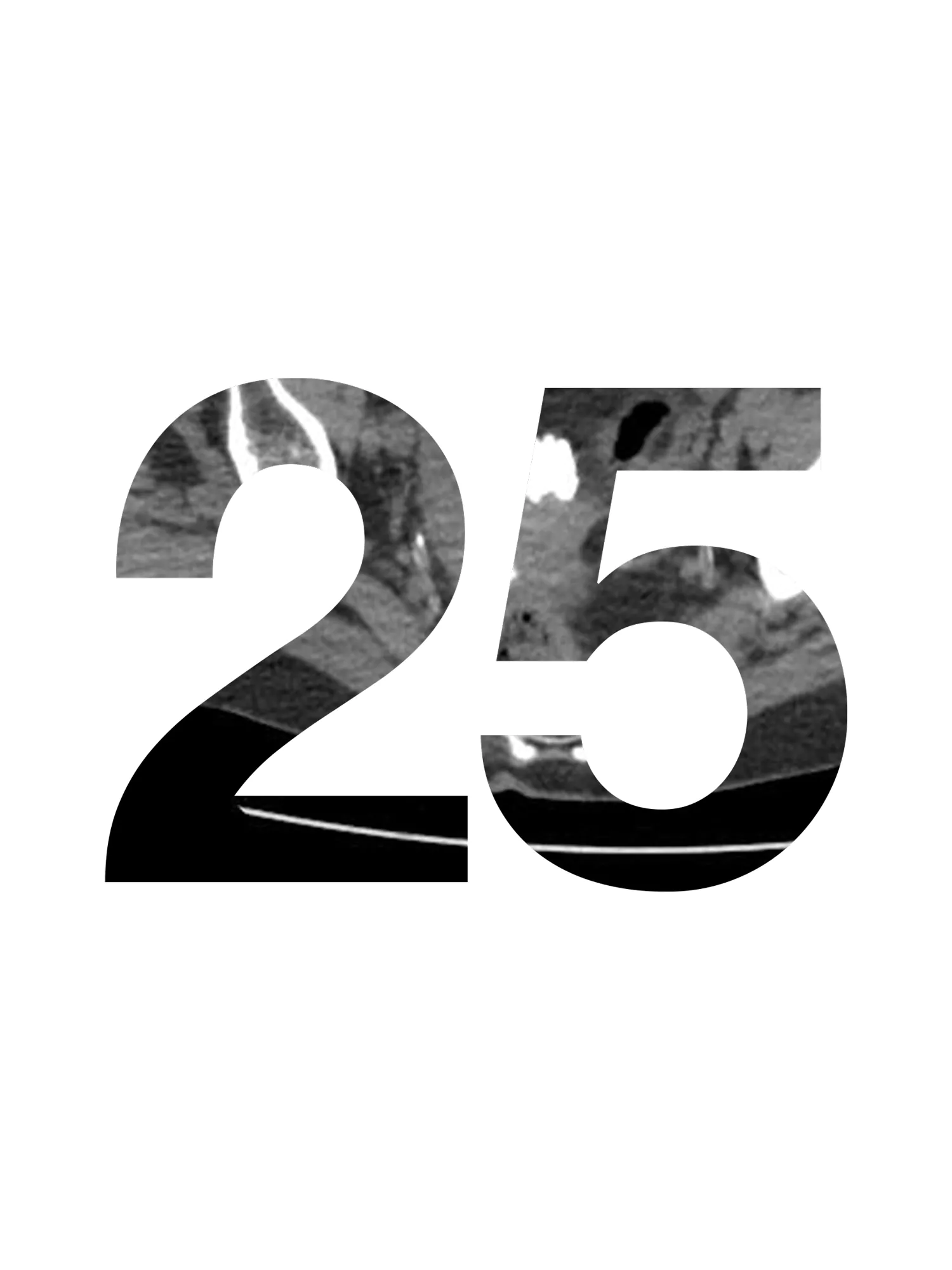 Door 25